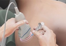 Ultrasound-Guided Shoulder Injections